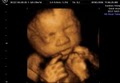 GoldenView Ultrasound 3D and 4D image 5