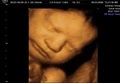 GoldenView Ultrasound 3D and 4D image 6