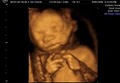 GoldenView Ultrasound 3D and 4D image 1
