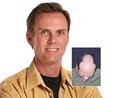 McGrath Medical Hair Transplantation image 4