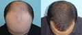 McGrath Medical Hair Transplantation image 6