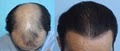 McGrath Medical Hair Transplantation image 8