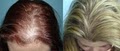 McGrath Medical Hair Transplantation image 10