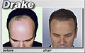 Medical Hair Restoration image 9