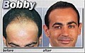 Medical Hair Restoration image 10
