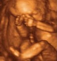 Prenatal Ultrasound of Glendale image 2