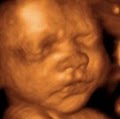 Prenatal Ultrasound of Glendale logo
