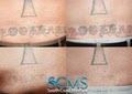 SOUTH COAST MEDSPA and LASER HAIR REMOVAL LOS ANGELES image 7
