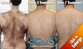 SOUTH COAST MEDSPA and LASER HAIR REMOVAL LOS ANGELES image 9