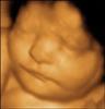 Belly View Ultrasound logo