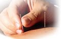 Biggs Chiropractic & Acupuncture image 4