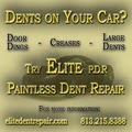 Elite Dent Repair and Removal image 1