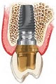 Manhattan Dental Implants Center image 1