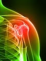 Utah Spine and Disc-Salt Lake City Spinal Decompression,LiteCure Laser,Back Pain image 6