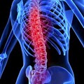 Utah Spine and Disc-Salt Lake City Spinal Decompression,LiteCure Laser,Back Pain image 10
