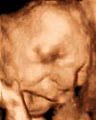 Bluebonnet Diagnostic Imaging 3D Ultrasound image 2