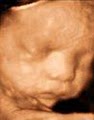 Bluebonnet Diagnostic Imaging 3D Ultrasound image 4
