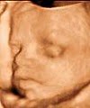 Bluebonnet Diagnostic Imaging 3D Ultrasound image 7