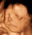Bluebonnet Diagnostic Imaging 3D Ultrasound image 8
