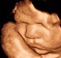 Bluebonnet Diagnostic Imaging 3D Ultrasound image 9