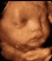 Bluebonnet Diagnostic Imaging 3D Ultrasound image 10