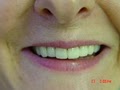 Caliber Dental image 4