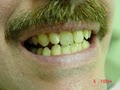 Caliber Dental image 5