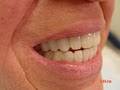 Caliber Dental image 8