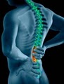 Gaithersburg Chiropractor @ THE Spinal Correction & Wellness Center 2 image 7