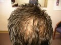 Hair Loss Control clinic image 3