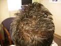 Hair Loss Control clinic image 4