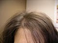 Hair Loss Control clinic image 5