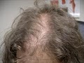 Hair Loss Control clinic image 6