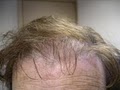 Hair Loss Control clinic image 7