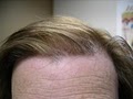 Hair Loss Control clinic image 8