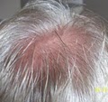 Hair Loss Control clinic image 1
