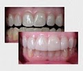 Valley Dental Group: Agoglia Joseph DDS image 4