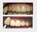 Valley Dental Group: Agoglia Joseph DDS image 5