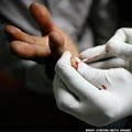 STD and HIV Testing image 9
